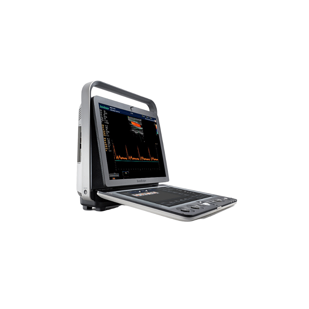 Sonoscape S9 - Ultrasound Color Doppler