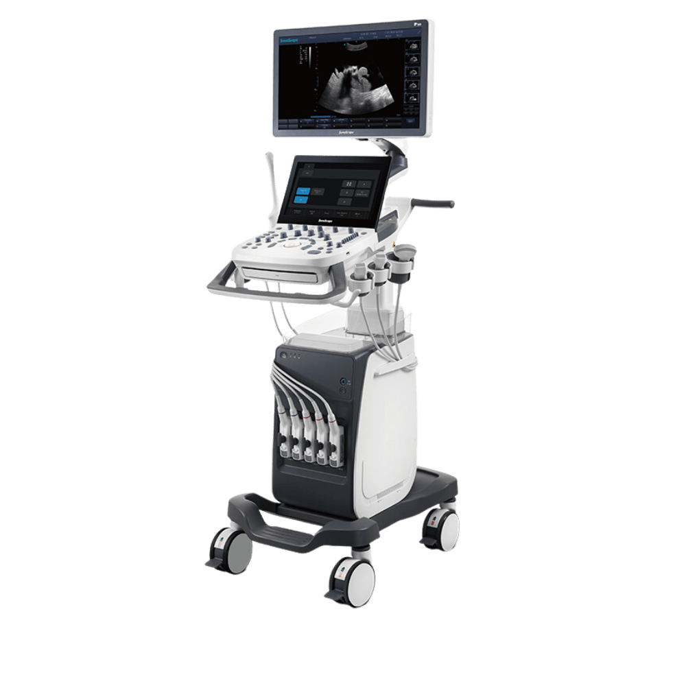 Ultrasound-unit-Sonoscape-P10-Ultrasound medical equipment
