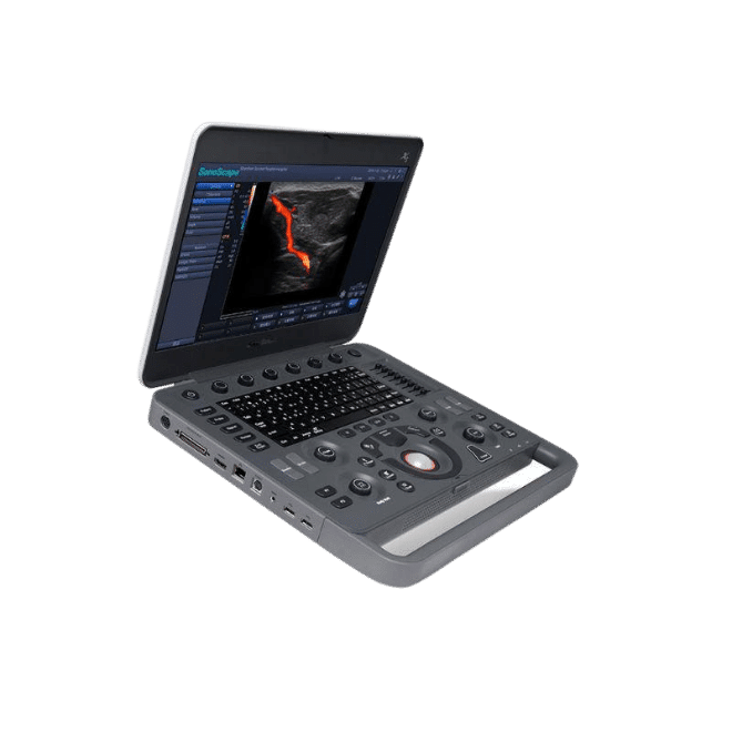Sonoscape X5 – Portable Ultrasound - canway