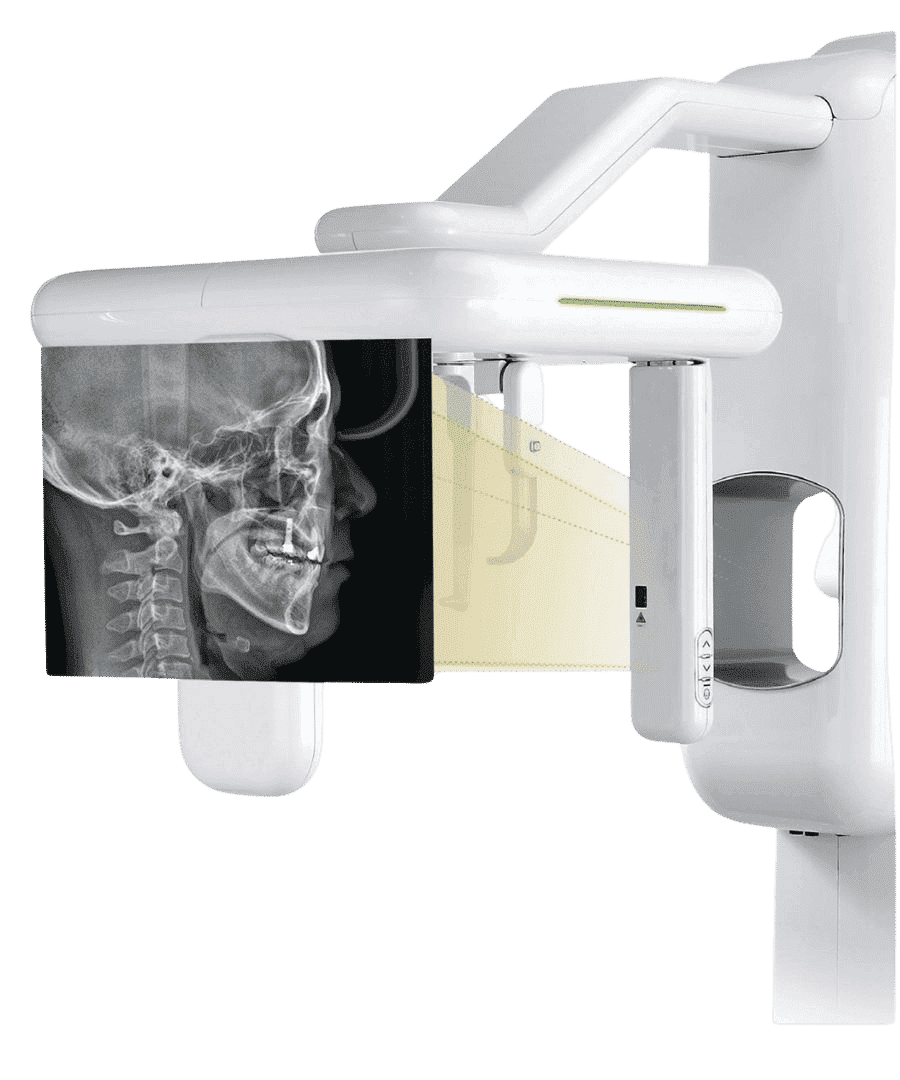 Dental OPG - x-ray Unit Dental OPG - x-ray Unit