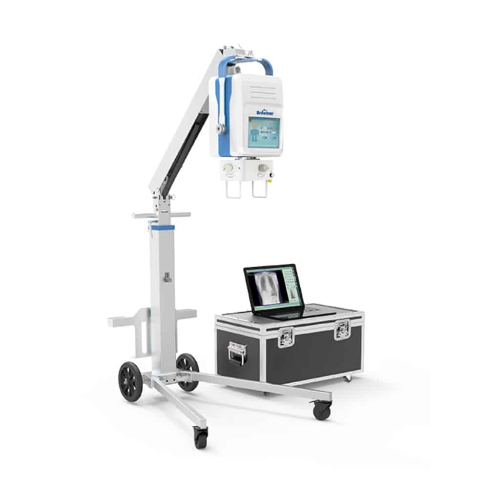 Beatle-06P1 - Portable X-ray Beatle-06P1 - Portable X-ray from canway medical equipment supplier