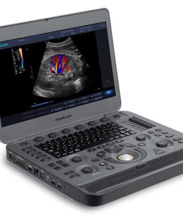 SonoScape X3 - Portable